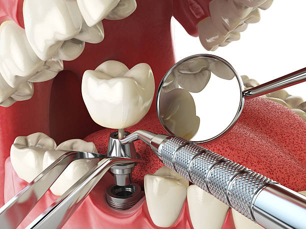 Best Urgent Dental Care in Pquemine, LA